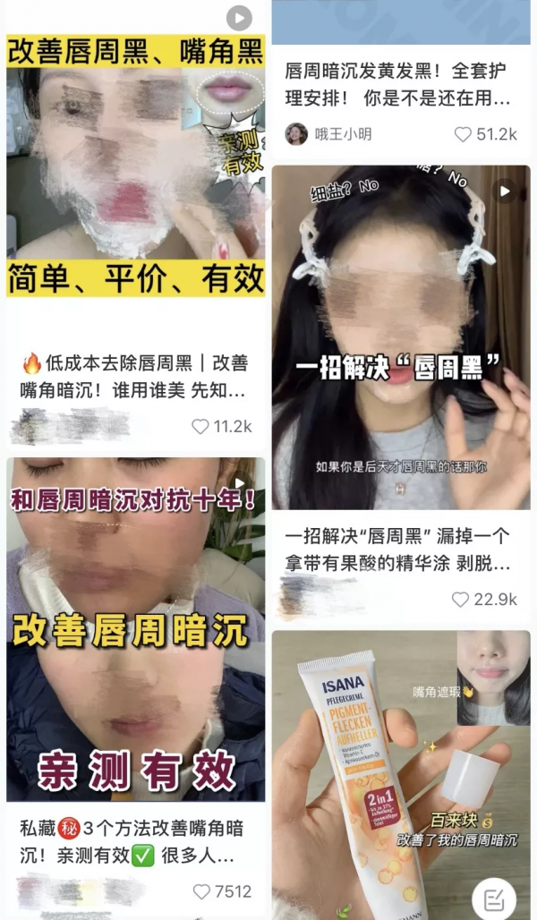 醜哭!唇周暗沉自救指南,做好這3件事讓你白回來 醜哭!唇周暗沉自救指南,做好這3件事讓你白回來