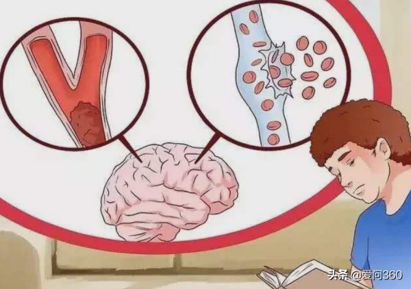 壽命短的人大多有這些壞習慣,幾個好習慣要堅持做 壽命短的人大多有這些壞習慣,幾個好習慣要堅持做