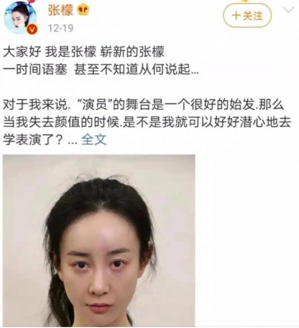 《美人心計》播出10年，9位美人差距很明顯，戲外整容卻毀容了