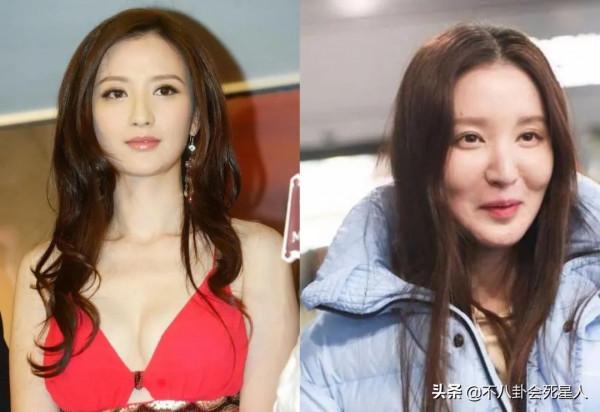 中年女星整容後遺症一堆！臉像鞋拔子，不敢做大表情，演戲沒法看