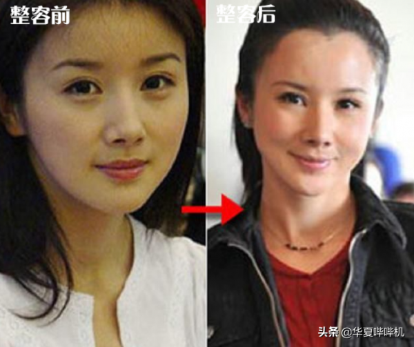 明星大型“翻車”現場，她們是如何整容變毀容的