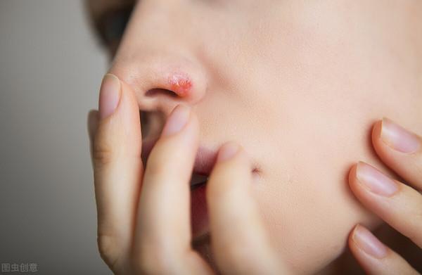 老是上火怎麼辦？簡單五味中藥，清清你的心、肝、肺、胃、腎之火