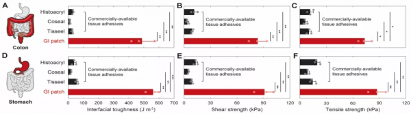 華科校友研發可降解&OpenCurlyDoubleQuote;腸道創可貼&rdquo;，能用於胃腸道缺損無縫修復