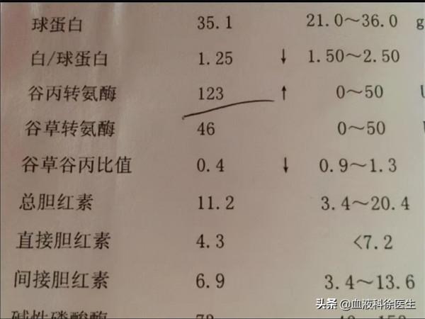 谷丙轉氨酶和穀草轉氨酶都偏高怎麼辦？