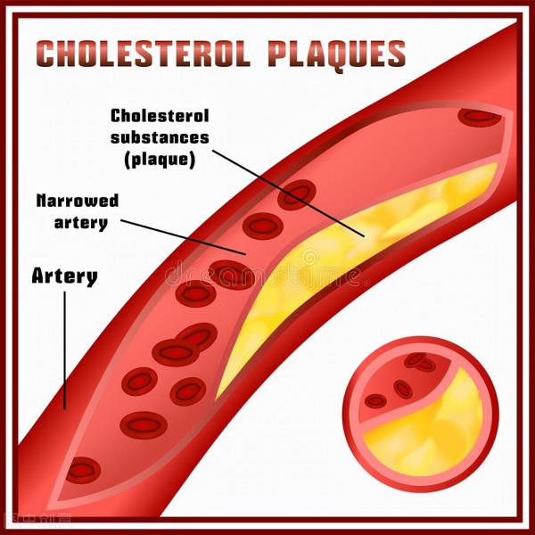 血管真的需要排毒嗎？這4個關於血管的真相你一定要知道
