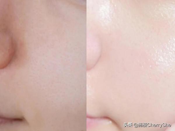 蘭蔻小黑瓶和歐萊雅黑精華，哪個更好用？