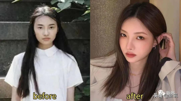 如果早知道整形天花板這件事,舒暢也不至於臉變成這樣... 如果早知道整形天花板這件事,舒暢也不至於臉變成這樣...