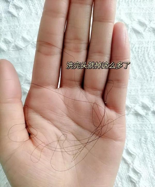 養髮堅持大半年,我來炫耀髮量啦 養髮堅持大半年,我來炫耀髮量啦