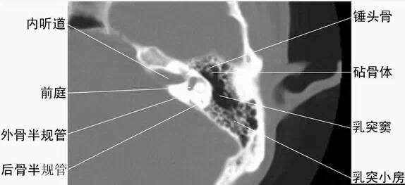 頭頸五官CT斷層解剖圖及常見病影像診斷