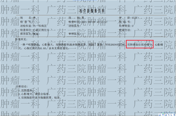 廣藥三院腫瘤一科丨心包積液會有什麼表現？
