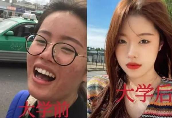 大學四年前後對比照火了,多數學生逆襲成功,醫學生卻是例外 大學四年前後對比照火了,多數學生逆襲成功,醫學生卻是例外