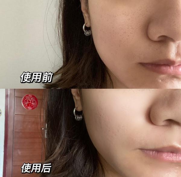 本以為這些網紅護膚品，都是雞肋貨，用過後才發現是我錯怪它們了