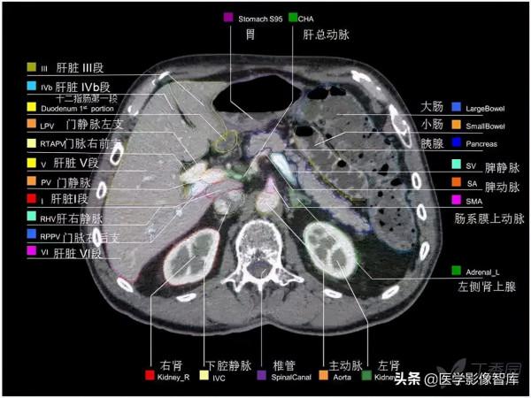 CT斷層解剖圖譜最全總結「推薦收藏」 CT斷層解剖圖譜最全總結「推薦收藏」