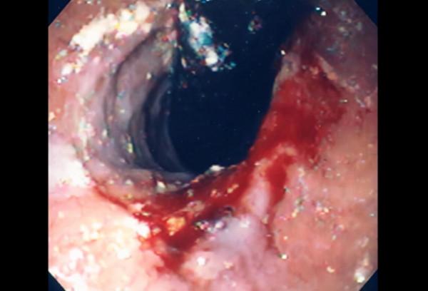 還沉迷於酒的世界嗎？天天喝酒有多可怕，快看看