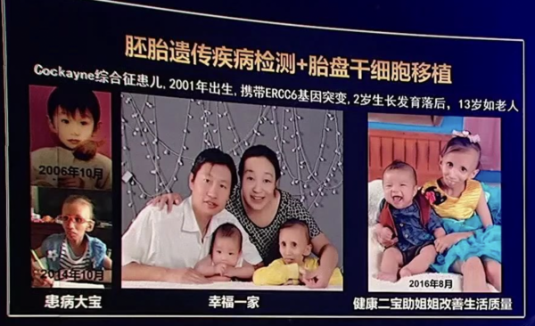 菲律賓16歲美少女,突然變成60歲老太太,顯得比母親還老,為啥? 菲律賓16歲美少女,突然變成60歲老太太,顯得比母親還老,為啥?