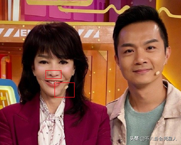 港圈美人也動臉，這10位女星，動臉後有人變刻薄，有人面目全非