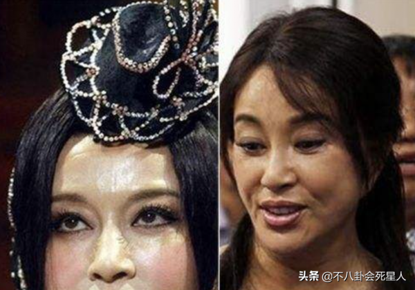 中年女星整容後遺症一堆！臉像鞋拔子，不敢做大表情，演戲沒法看