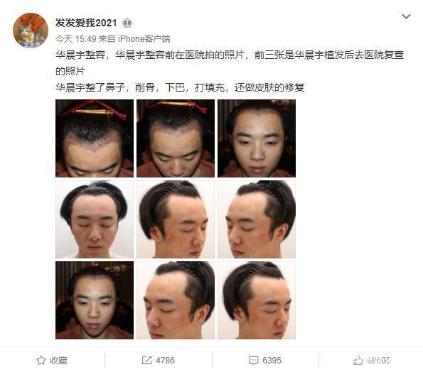 娛樂圈男星換臉大比拼：有人削骨，有人隆鼻，有人直接“換頭”