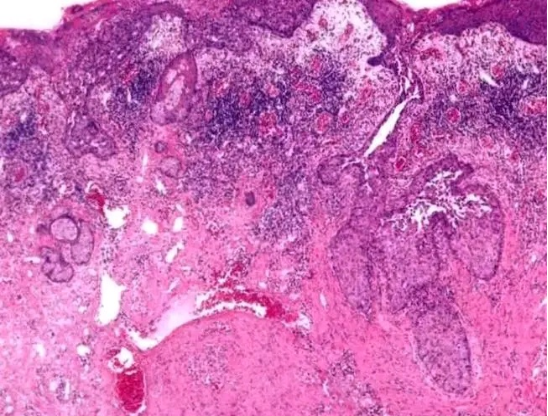 50歲後查腦CT，出現這4種問題，不需要特殊治療，別被坑了