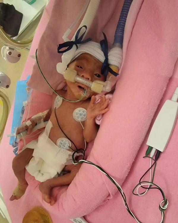 “我的孩子在新加坡早產,只有1kg重!面臨35萬天價賬單......” “我的孩子在新加坡早產,只有1kg重!面臨35萬天價賬單......”