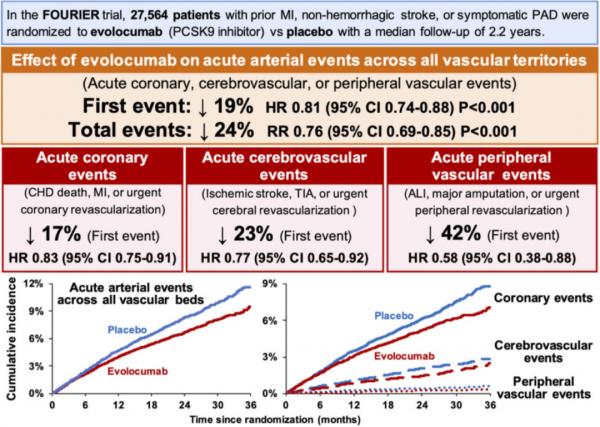 進展 | PCSK9抑制劑減少高危患者所有部位血管的急性動脈事件復發 進展 | PCSK9抑制劑減少高危患者所有部位血管的急性動脈事件復發
