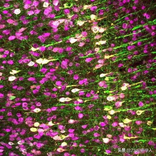 超聲波或可啟用哺乳動物的大腦、心臟及其他細胞