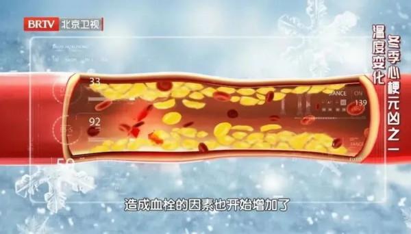 早晨醒來,第一件事竟然不是急著起床?院長分享3大“法寶”,護血管、強心臟,冬天尤其適用 早晨醒來,第一件事竟然不是急著起床?院長分享3大“法寶”,護血管、強心臟,冬天尤其適用