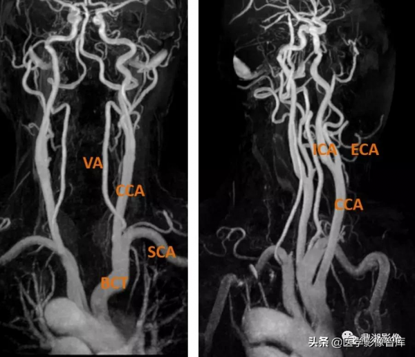 CT斷層解剖圖譜最全總結「推薦收藏」 CT斷層解剖圖譜最全總結「推薦收藏」