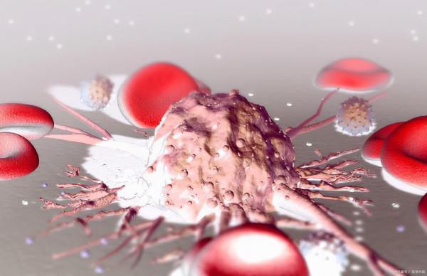 為何有人會感覺全身疼痛?可能與這4個原因有關,不妨自查一下 為何有人會感覺全身疼痛?可能與這4個原因有關,不妨自查一下