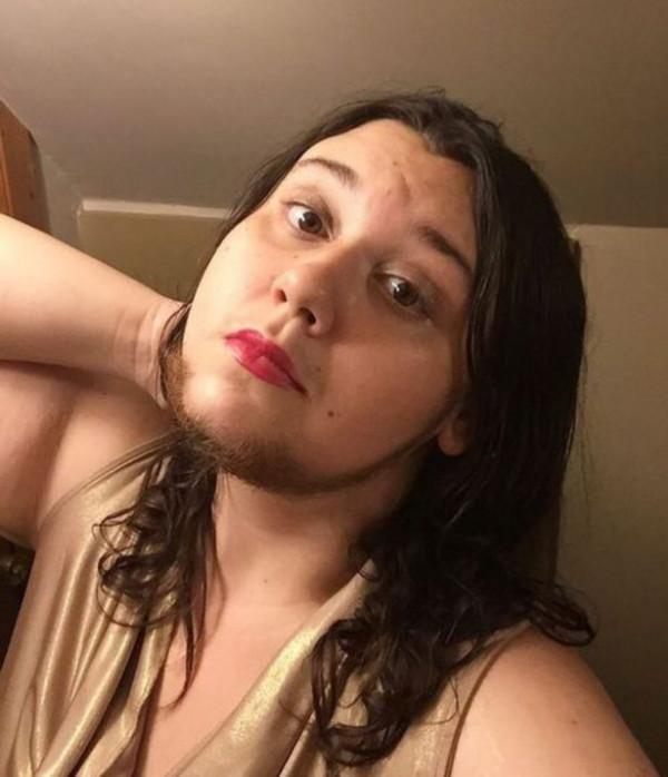 美國女子毛髮旺盛，曾感到很羞愧，如今大方曬出鬍子覺得自豪