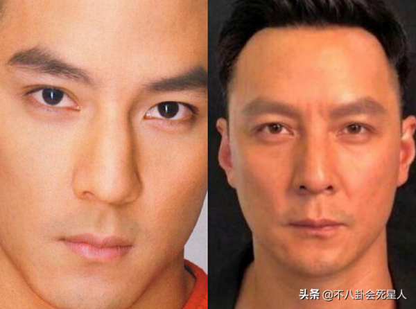 8位嘴唇變薄的明星，古天樂林峰被吐槽又老又醜，董潔女神變路人