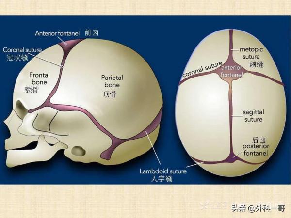 小兒顱縫早閉的診斷治療