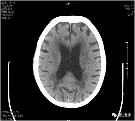 “正常”的心率背後也可能隱藏著危險，體溫脈搏呼吸血壓你真的讀懂了嗎？