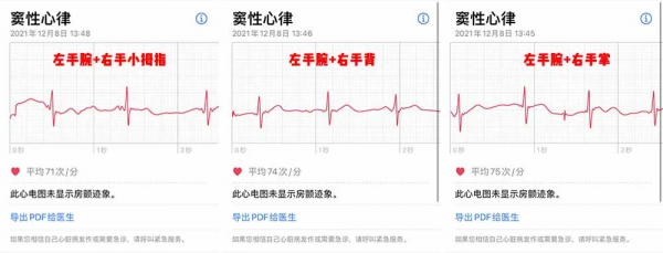 等了 3 年，國行版 Apple Watch 心電圖功能終於來了