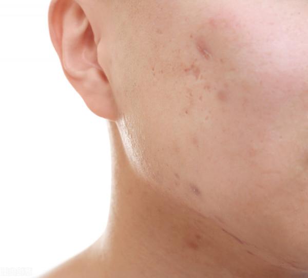 面板出現以下異常，提示你腎臟出現問題，小心腎衰竭來襲