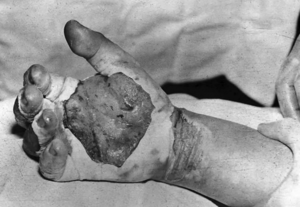 美國為日本準備的第三枚原子彈，為何會“反殺”美國科學家？