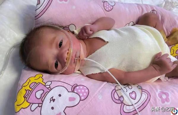 早產兒出生僅1公斤，呼吸微弱生命垂危，未料幾分鐘後起死回生