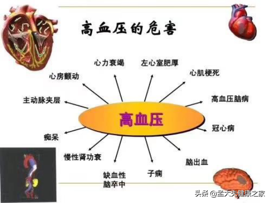 家裡老人突發腦溢血，懂得急救很重要：4個步驟記清楚，能救命