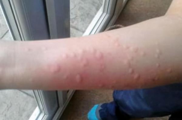 常吃鵝蛋,對身體有益還是有害?提醒:這4類人建議少吃鵝蛋為好 常吃鵝蛋,對身體有益還是有害?提醒:這4類人建議少吃鵝蛋為好