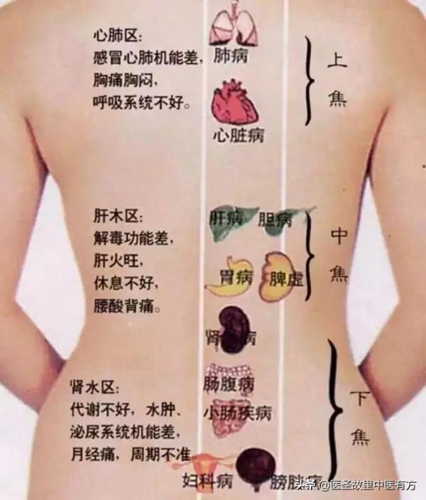 身體反反覆覆出毛病，檢查卻總是沒問題？很可能是你三焦堵了