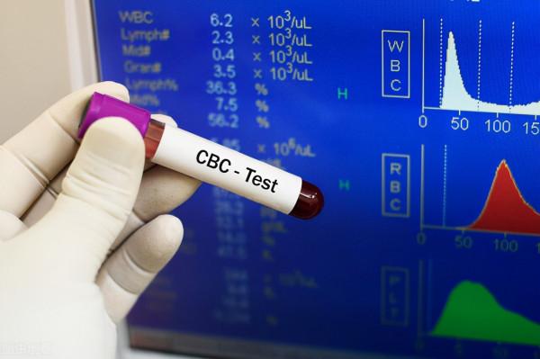 很多人可能都不知道，血常規指標可以推算腫瘤預後