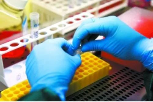 大千世界,無奇不有,有人高價回收孕婦尿,這有什麼用? 大千世界,無奇不有,有人高價回收孕婦尿,這有什麼用?