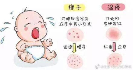 如何鑑別孩子起的是溼疹還是痱子？