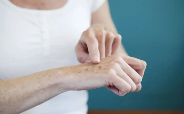 別踩雷啦,安全有效的美白淡斑攻略在這 別踩雷啦,安全有效的美白淡斑攻略在這