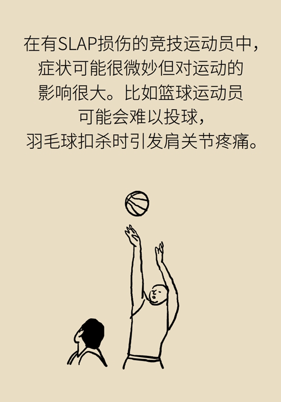 健身房裡最常發生的肩痛，該怎麼應對？