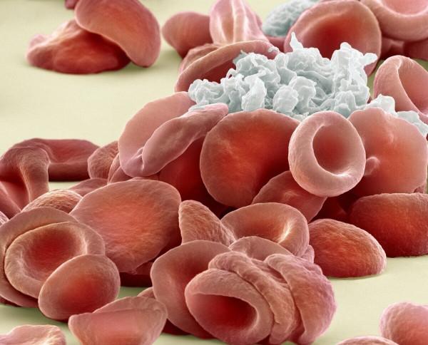 冠心病需要多藥聯合治療,哪種藥物更重要?核心用藥不能停 冠心病需要多藥聯合治療,哪種藥物更重要?核心用藥不能停