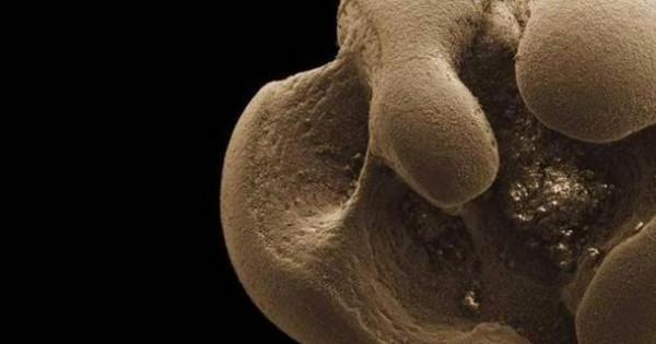 科學家發現以金屬為食的新品種細菌，百年前的預言，終於得到證實