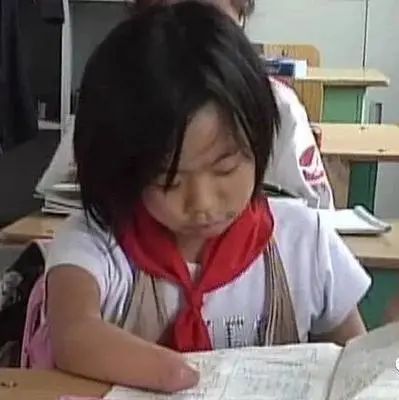 勵志女孩李欣雨：汶川地震讓她失去右手，高考625分考入華中師範