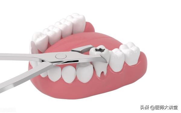 注意：拔牙後出現發熱，臨床病例分享