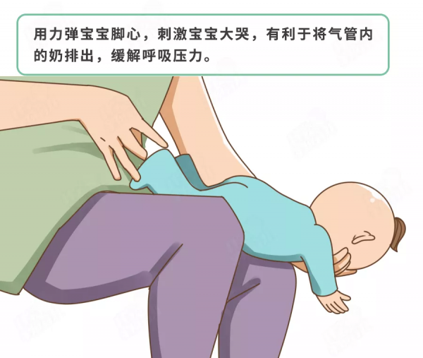 娃嗆奶後，4個動作能救命！希望你用不到，但必須會